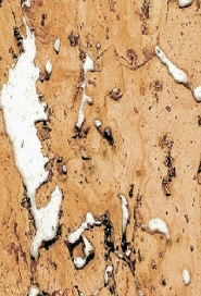 IPOCORK
